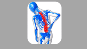 Dor lombar irradiada: quando a dor não fica só nas costas